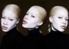 model-albinos